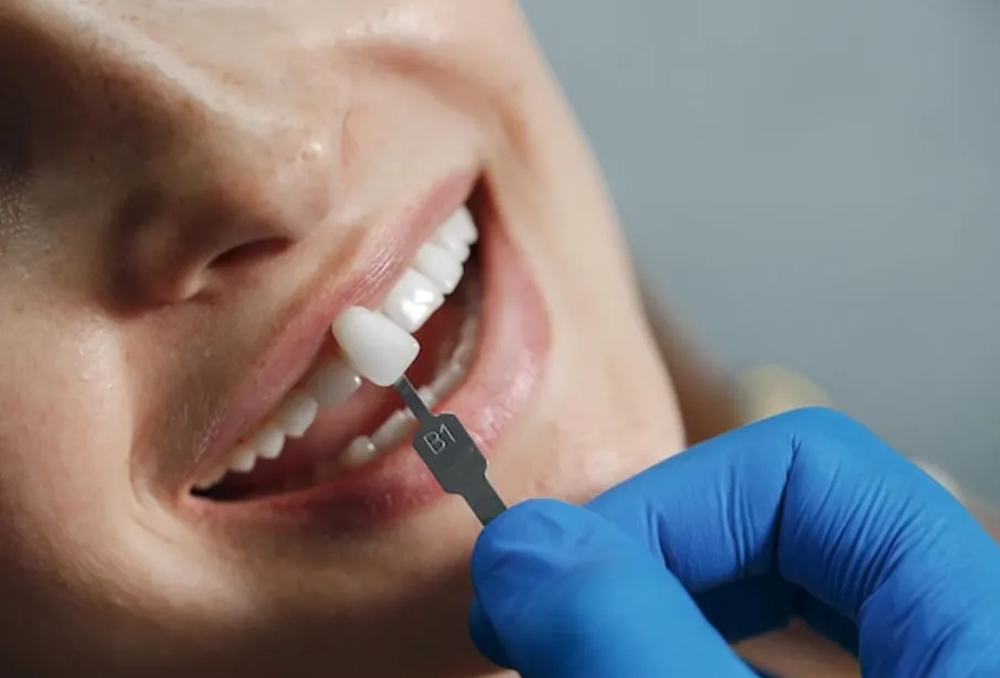 Top Dental Treatments You Can Get From A Dentist In Hamilton 1